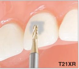 T21XR