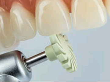 CompGloss - para el pulido de alto brillo intraoral de todos los materiales de obturación de composite