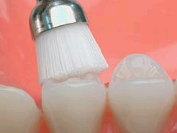 Prophylaxis Brushlets (RA) - cepillos de nylon para contraángulo