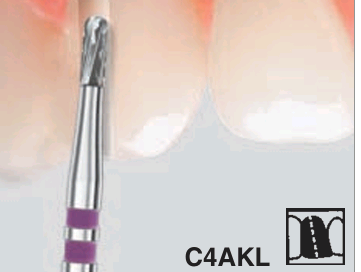 C4AKL (metal)