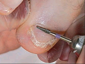 Dentado helicoidal 24 / 25