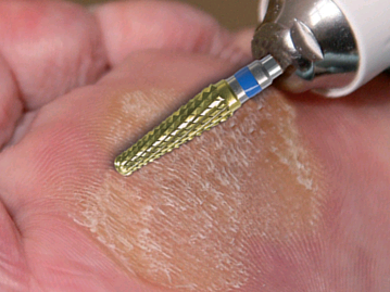 Corte de diamante medio AC