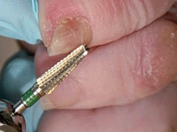 Dentado simple con corte transversal AC