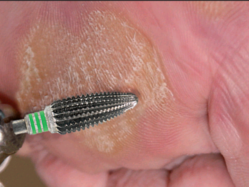 Dentado simple con corte transversal 75