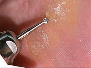 Fresa redonda de acero