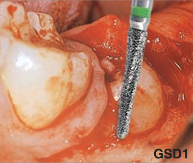 GSD1.314.016